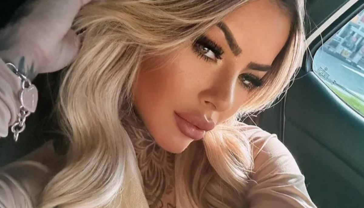 Influencer dies days after plastic surgery: Are cosmetic procedures really safe?
