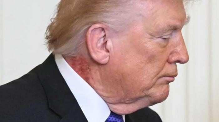 From aspirin to cream: White House links President Trump’s neck rash to ‘preventative’ skin treatment
