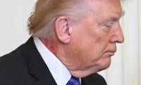 From Aspirin To Cream: White House Links President Trump’s Neck Rash To ‘preventative’ Skin Treatment