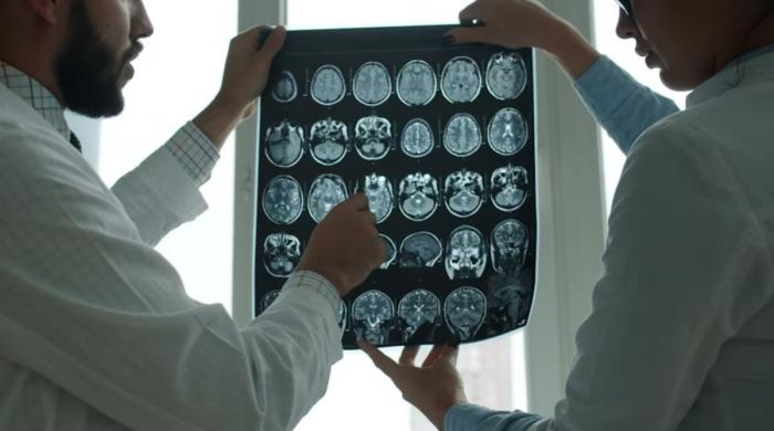 Shopify CEO uses Claude AI to build MRI viewer