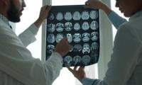 Shopify CEO Uses Claude AI To Build MRI Viewer