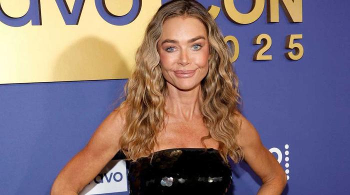 Denise Richards speaks out on surprising changes after undergoing facelift