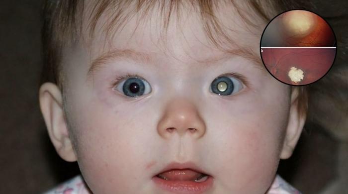 Eye drops made from pig body fluid could revolutionize cancer treatment, new study says