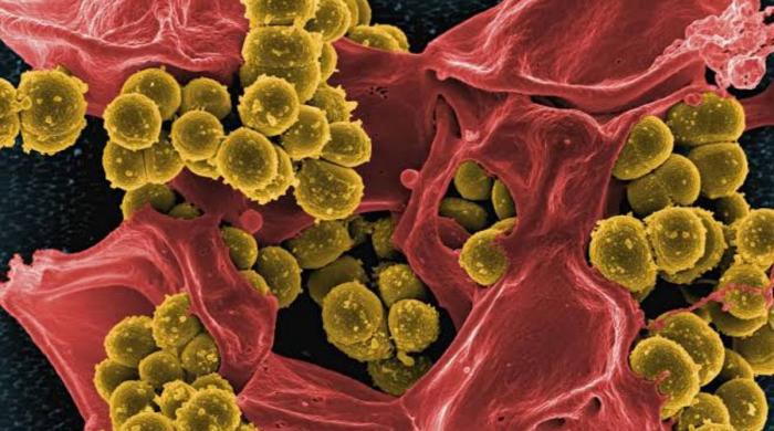 London sewage detects polio weeks after funding drop