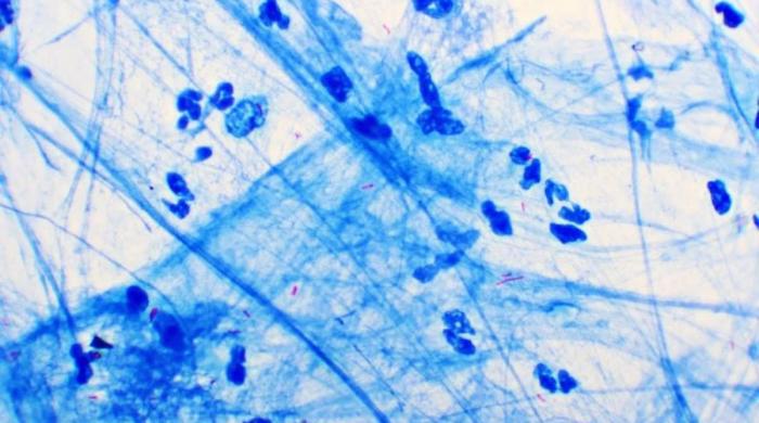 How a new blood test detects active, infectious Tuberculosis: Here’s everything to know