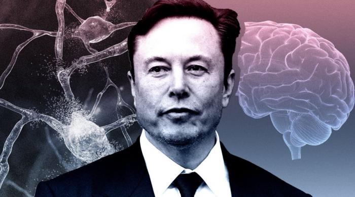 Elon Musk highlights Neuralink’s potential for restoring vision and hearing