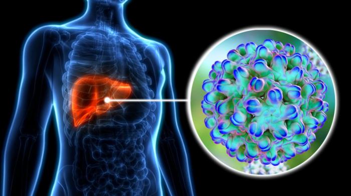 New drug in clinical trial may finally treat hepatitis E 