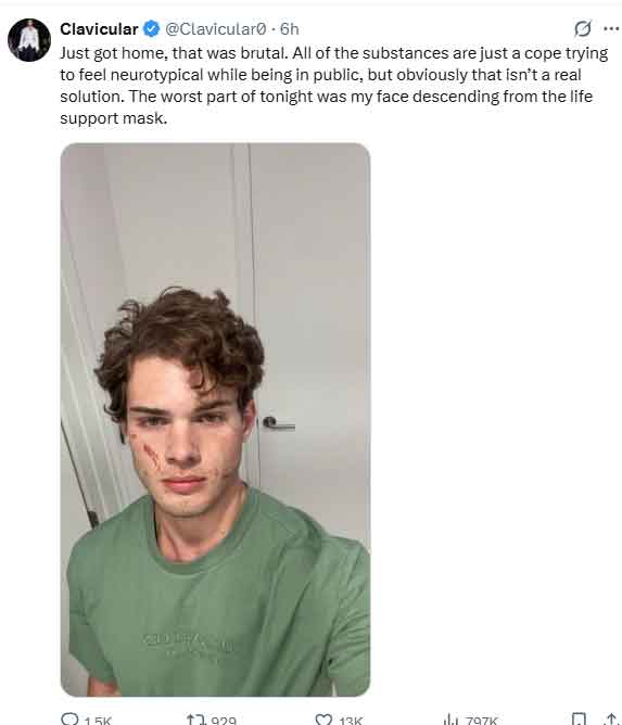 Clavicular not dead: Braden Peters overdose scare sparks rumors
