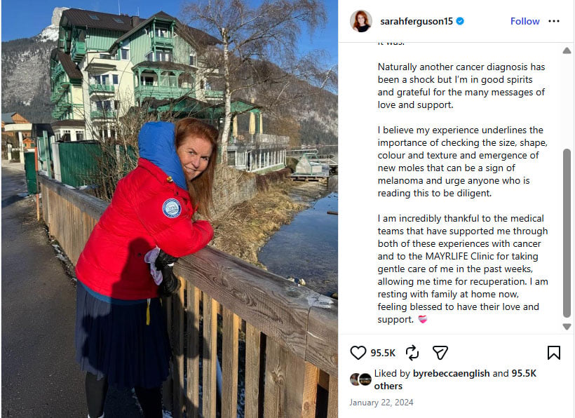 Sarah Ferguson second cancer battle: Managing skin cancer while resort hopping