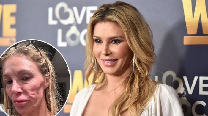 Brandi Glanville shares new diagnosis after after parasite concerns return