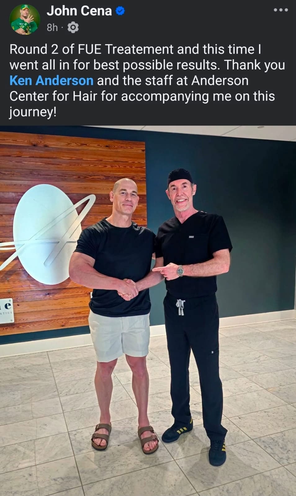 John Cena reveals dramatic new look ahead of second hair transplant