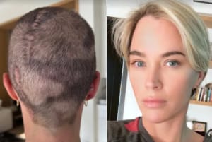 Teddi Mellencamp gives positive update amid stage 4 brain cancer