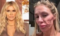 Brandi Glanville Calls Out Doctors Amid Ongoing Facial Disfigurement Struggle