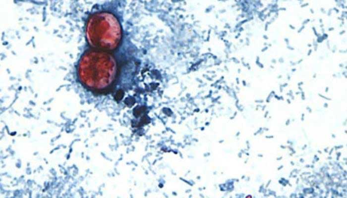 Cyclospora outbreak: is the diarrhoea-causing parasite spreading to Canada?