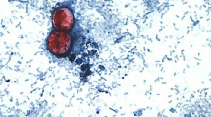 Cyclospora outbreak: is the diarrhoea-causing parasite spreading to Canada?