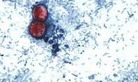 Cyclospora outbreak: is the diarrhoea-causing parasite spreading to Canada?