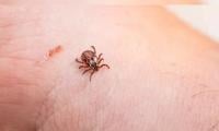 Tick-borne anaplasmosis on the rise in Canada, CMAJ study warns