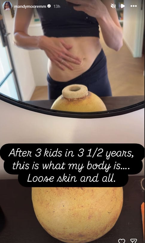 Mandy Moore bares reality of motherhood with her unfiltered post-baby body glimpse