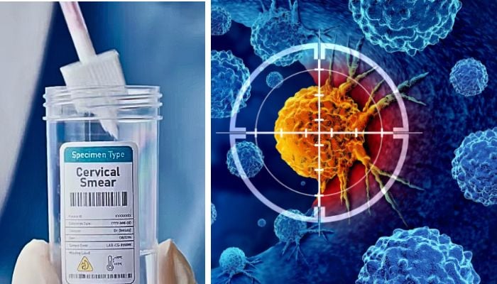 NHS England to roll out free home testing kits for cervical cancer