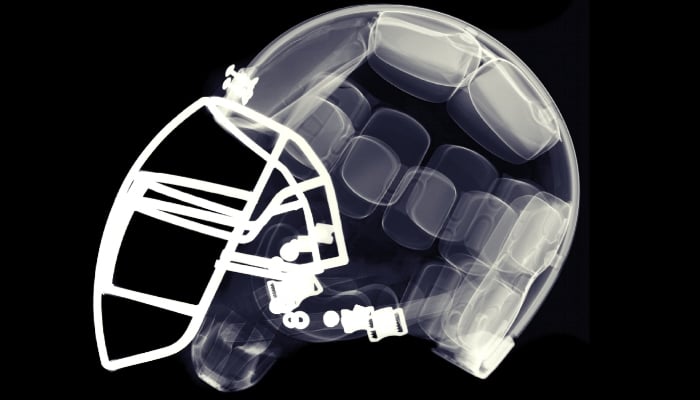 Former NFL players faced four times higher neurodegenerative death rate, study finds