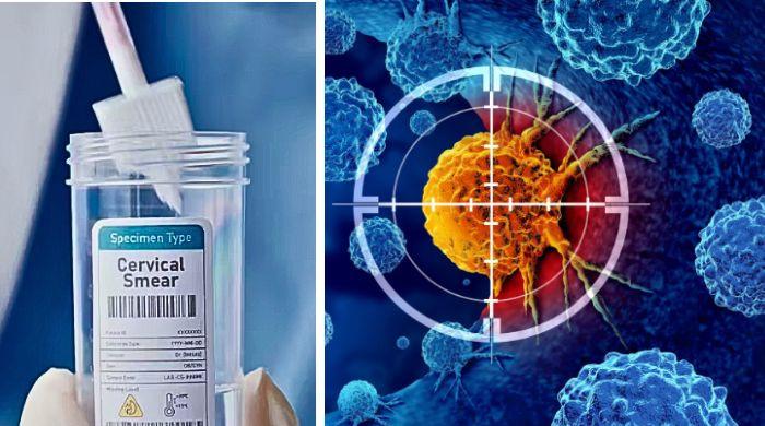 NHS England to roll out free home testing kits for cervical cancer
