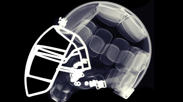 Former NFL players faced four times higher neurodegenerative death rate, study finds