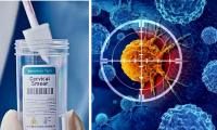 NHS England to roll out free home testing kits for cervical cancer