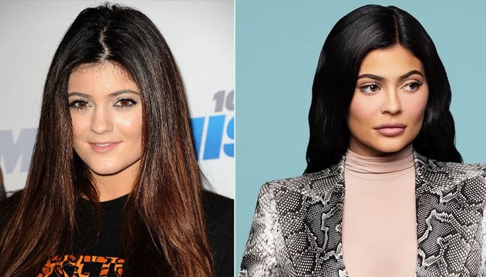Kylie Jenner drops major hint about her next beauty procedure: I want them bigger