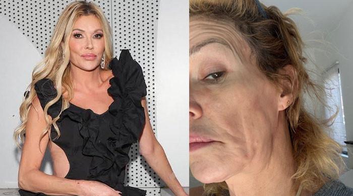 Brandi Glanville 'embarrassed' to accept fundraiser help