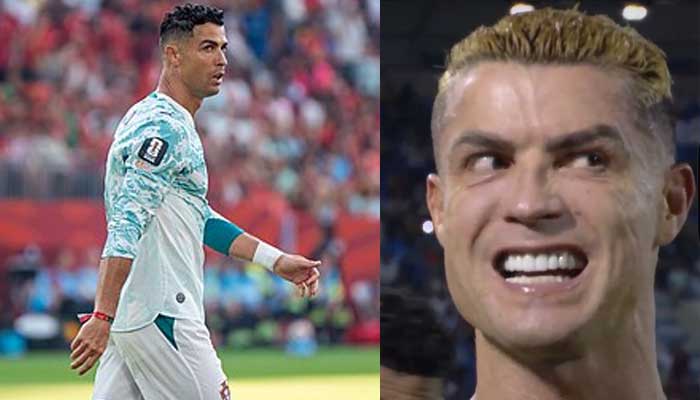 Cristiano Ronaldos forehead sparks Botox debate