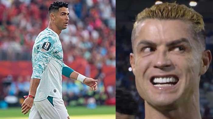 Cristiano Ronaldo's forehead sparks Botox debate 