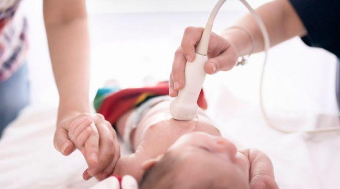 Study reveals why some babies are born with heart defects
