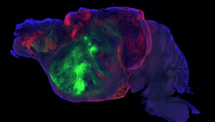 Scientists transplant lab-grown human brain tissue into mice: What they found