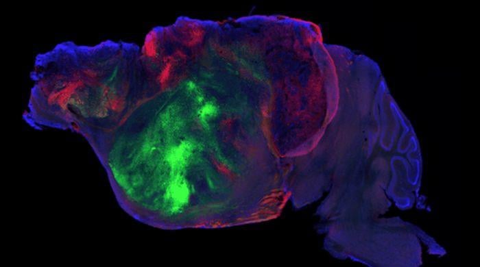 Scientists transplant lab-grown human brain tissue into mice: What they found