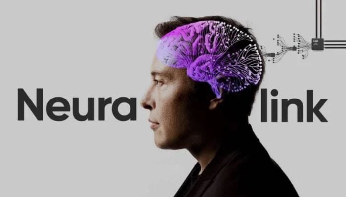 Elon Musks Neuralink patient uses brain implant to say I Love You
