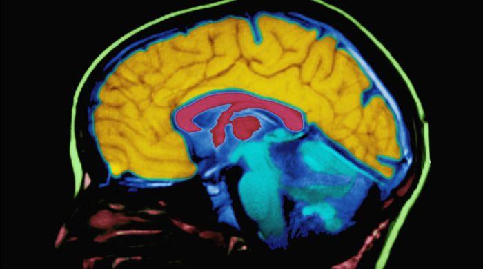 Was the human brain once two separate organs? Scientists find new clues