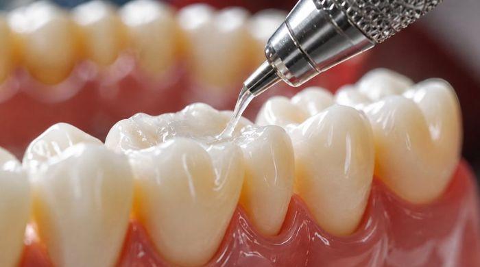 University of Nottingham researchers say new gel could regrow tooth enamel in weeks
