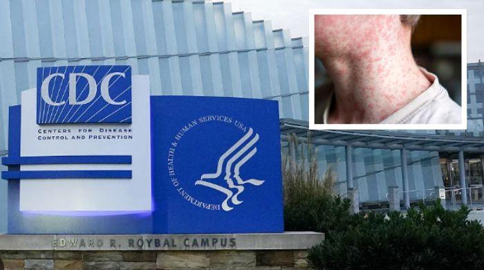 Measles cases in US top 4,000 nationwide, CDC reports