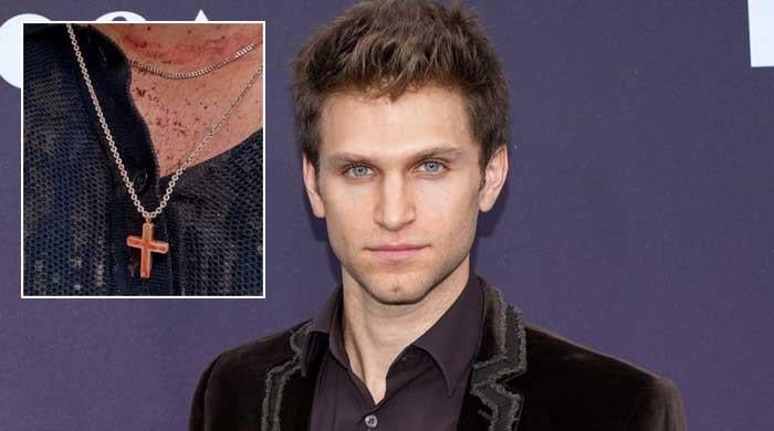 Keegan Allen shares 'painful' update after being violently attacked in armed robbery