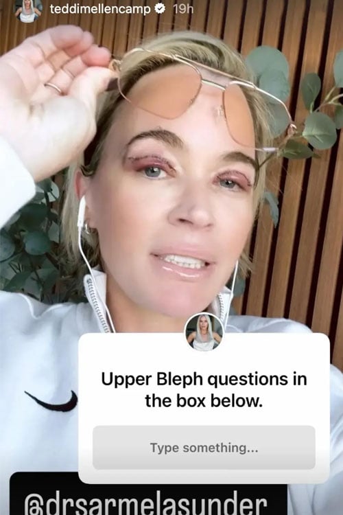 Teddi Mellencamp gets honest about her plastic surgery amid stage 4 cancer battle