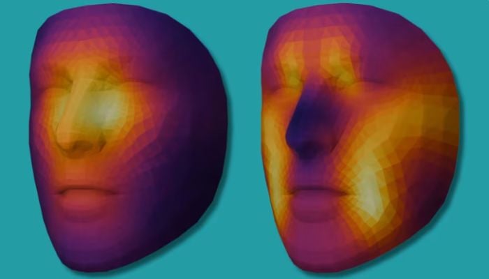 AI tool can now predict cancer survival by a single patient selfie: Find out how