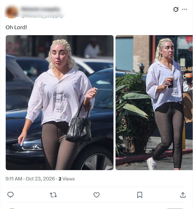 Amanda Bynes gives Hollywood a little glimpse since turning to Ozempic: Pics